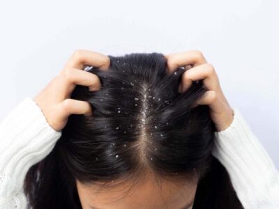 Combating Lice Effectively: Top Anti-Lice Shampoo Available in Pakistan